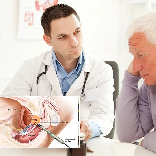 Your Trusted Partner in Penile Implant Surgery and Recovery