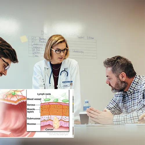 Understanding Penile Implants